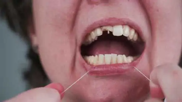 Apa-itu-Flossing-Gigi-dan-Cara-Melakukannya-dengan-Benar-Guide-Wallpaper-4K