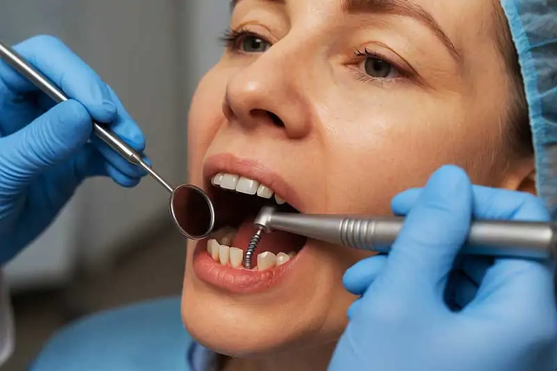Dental-Implant-Procedures-Types,-Benefits,-and-Options-in-Bali-Guide