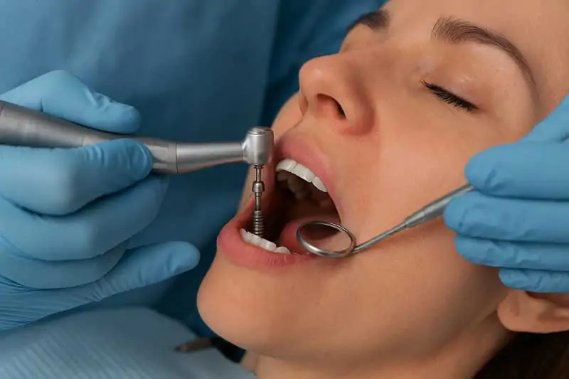 Dental-Implant-Procedures-Types,-Benefits,-and-Options-in-Bali-Wallpaper