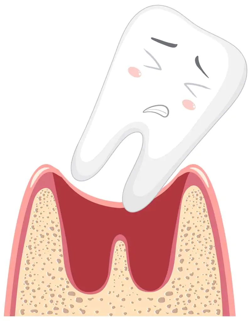 Benefits-of-keeping-wisdom-teeth
