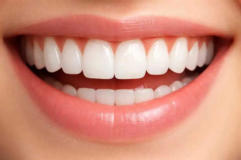 Fungsi-Gigi-Seri-dan-Perawatan-Gigi-Seri-Bali-Terbaik