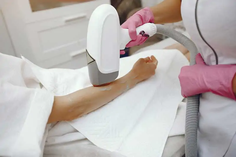 How-long-does-laser-hair-removal-last