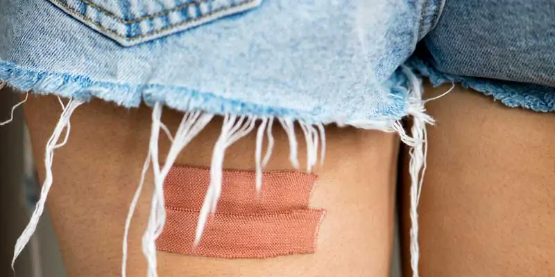 What-is-The-Fastest-Treatment-for-Keloids-Here's-the-Guide-2026