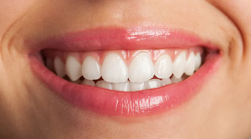The-Best-Way-to-Whiten-Your-Teeth-2026