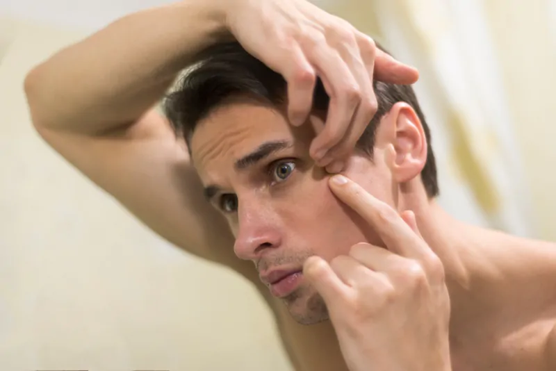 What-is-The-Cause-of-Forehead-Acne-The-Ultimate-Guide-wallpaper