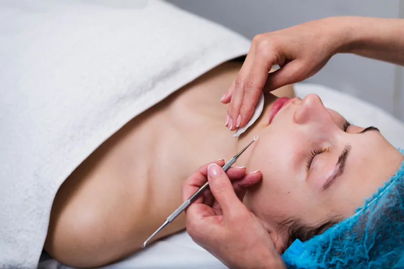 Jerawat-Meradang-Apakah-Boleh-Facial-Intip-Faktanya-di-Sini