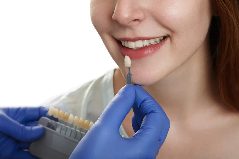 What-is-the-best-way-to-whiten-my-teeth-wallpaper