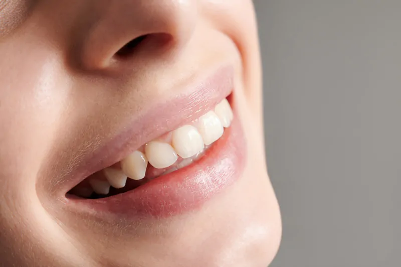 What-is-the-best-way-to-whiten-my-teeth