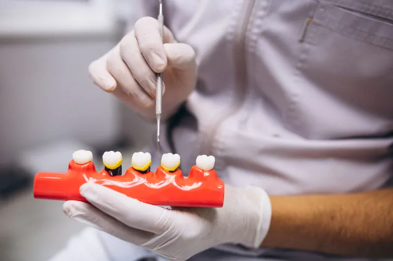 Dental Bridge vs Implant Which One Suits You