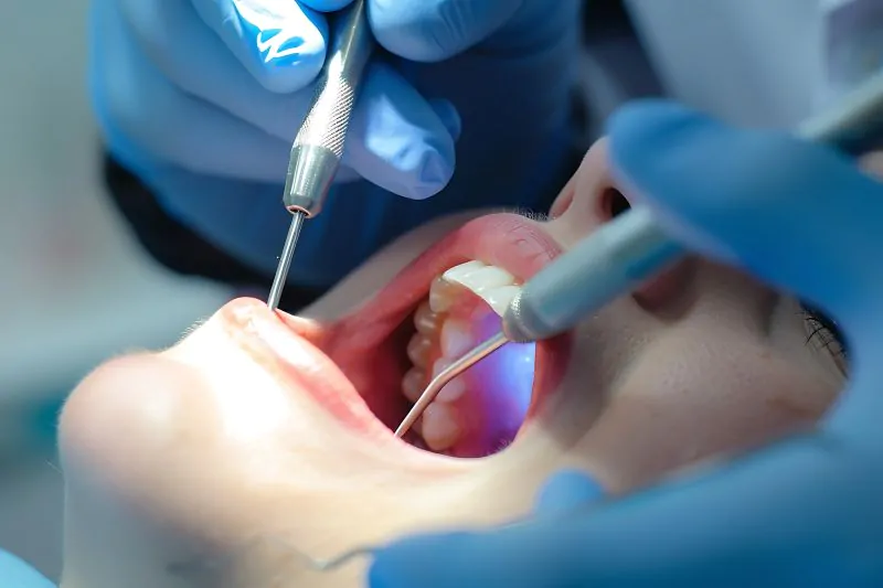 Root Canal Before and After Guide for Australian in Bali wallpaper