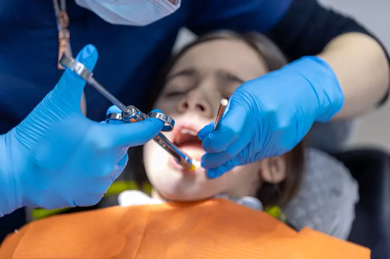 Teeth Bonding vs. Veneers A Detailed Comparison Guide