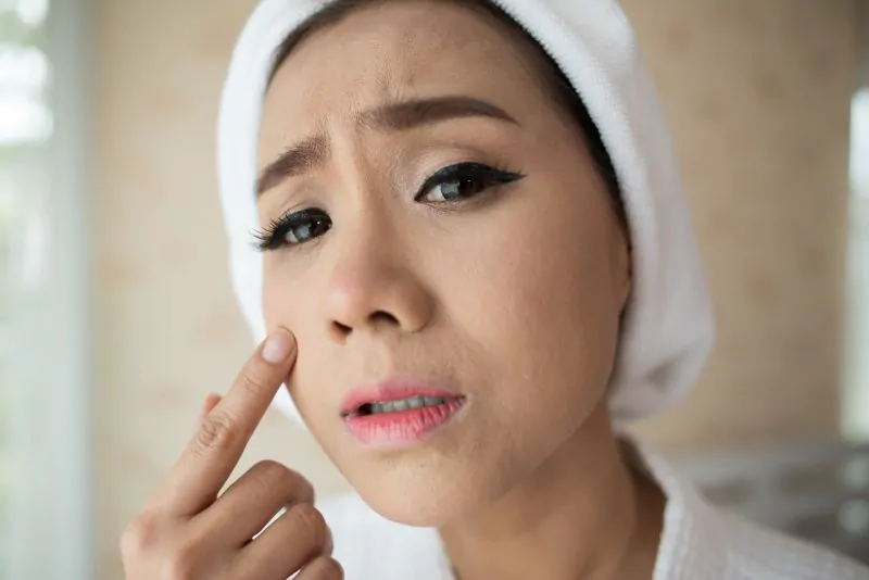 Inilah Penyebab Pori-pori Besar dan Cara Mengatasinya