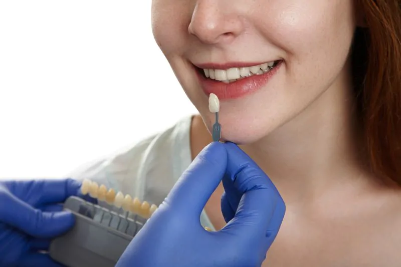Porcelain Veneers vs Composite Veneers, Which One Suitable for You